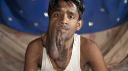 Body Bizarre My Son Has Three Arms