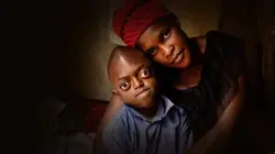 Body Bizarre My Son Has Three Arms