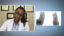 SOS pieds en détresse